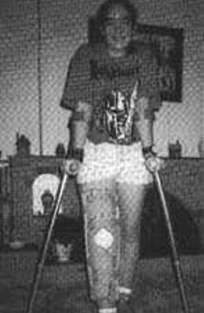 Advisor Sarah Halsall with crutches for The Quest, the Official Newsletter of the Knightmare Adventurers Club. Volume 2, Issue 2.